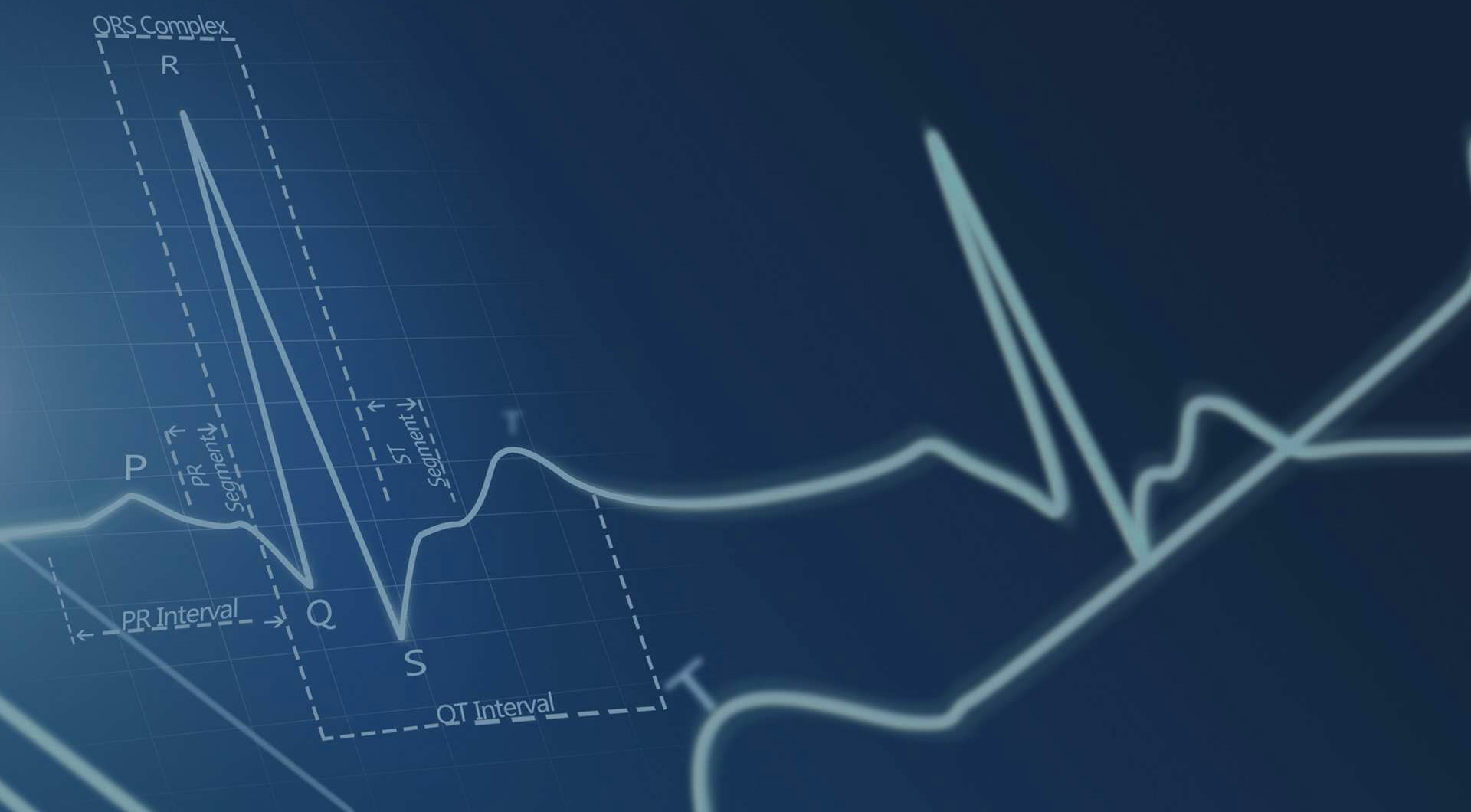 噪聲振動(dòng)檢測